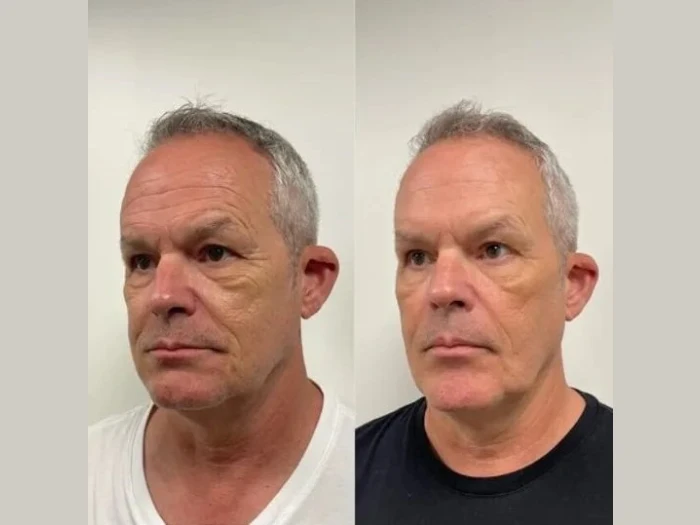 H4-male-facial